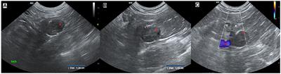 Case Report: Adrenal Epithelial Cyst in an 11-Year-Old Leptailurus Serval